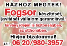 Fogsor készítése, javítása otthonában